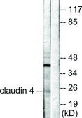 Anti-Claudin 4 antibody produced in rabbit affinity isolated antibody
