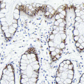 Anti-ELF3 antibody produced in rabbit Ab1, Prestige Antibodies® Powered by Atlas Antibodies, affinity isolated antibody, buffered aqueous glycerol solution