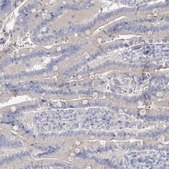 Anti-MYL6B antibody produced in rabbit Prestige Antibodies® Powered by Atlas Antibodies, affinity isolated antibody, buffered aqueous glycerol solution
