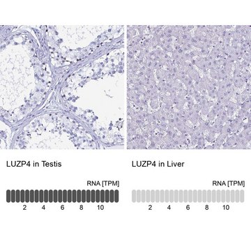 Anti-LUZP4 antibody produced in rabbit Prestige Antibodies&#174; Powered by Atlas Antibodies, affinity isolated antibody, buffered aqueous glycerol solution