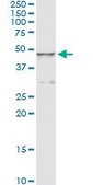 Monoclonal Anti-HGD antibody produced in mouse clone 1F1, purified immunoglobulin, buffered aqueous solution