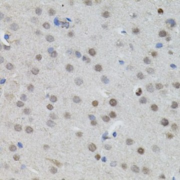 Anti-MYCN antibody produced in rabbit