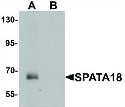 Anti-SPATA18 antibody produced in chicken affinity isolated antibody