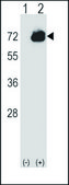 ANTI-CTPS2 (C-TERM) antibody produced in rabbit IgG fraction of antiserum, buffered aqueous solution