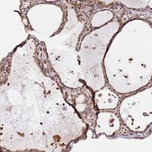 Anti-KATNAL2 antibody produced in rabbit Prestige Antibodies® Powered by Atlas Antibodies, affinity isolated antibody, buffered aqueous glycerol solution