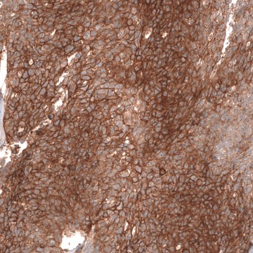 Monoclonal Anti-Fxyd5 Antibody Produced In Mouse Prestige Antibodies&#174; Powered by Atlas Antibodies, clone CL14037, affinity isolated antibody, buffered aqueous glycerol solution