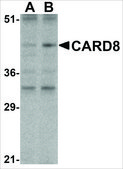 Anti-CARD8 antibody produced in rabbit affinity isolated antibody, buffered aqueous solution