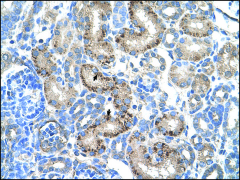 Anti-AADAT antibody produced in rabbit IgG fraction of antiserum