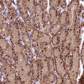 Anti-SBNO2 antibody produced in rabbit Prestige Antibodies® Powered by Atlas Antibodies, affinity isolated antibody, buffered aqueous glycerol solution