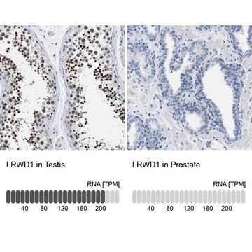 Anti-LRWD1 antibody produced in rabbit Prestige Antibodies&#174; Powered by Atlas Antibodies, affinity isolated antibody, buffered aqueous glycerol solution