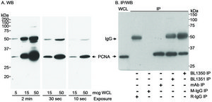 Rabbit anti-PCNA Antibody, Affinity Purified Powered by Bethyl Laboratories, Inc.