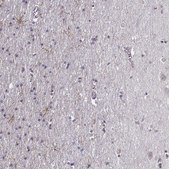 Anti-LUZP2 antibody produced in rabbit Prestige Antibodies® Powered by Atlas Antibodies, affinity isolated antibody, buffered aqueous glycerol solution