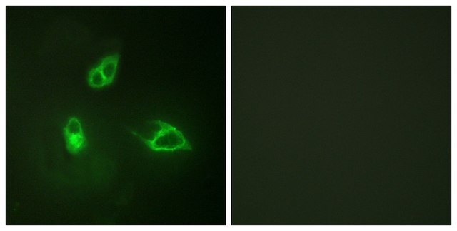 Anti-IL-8R &#946; antibody produced in rabbit affinity isolated antibody