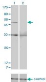 Monoclonal Anti-MMP13 antibody produced in mouse clone 3B11, purified immunoglobulin, buffered aqueous solution