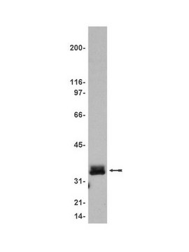 Anti-LAT Antibody, clone 2E9 clone 2E9, Upstate&#174;, from mouse