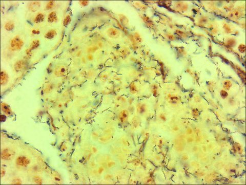 Spirochetes TISSUE-TROL&#8482; Control Slides rabbit testicle tissue containing spirochetes (Treponema pallidum)