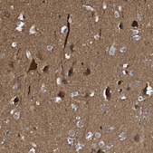 Anti-CRYM antibody produced in rabbit Prestige Antibodies® Powered by Atlas Antibodies, affinity isolated antibody, buffered aqueous glycerol solution