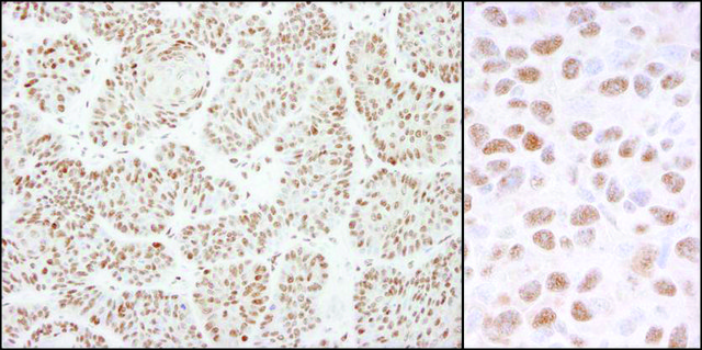 Rabbit anti-DDB1 Antibody, Affinity Purified Powered by Bethyl Laboratories, Inc.