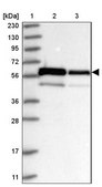 Anti-ZNF622 antibody produced in rabbit Prestige Antibodies® Powered by Atlas Antibodies, affinity isolated antibody, buffered aqueous glycerol solution