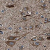 Anti-ARFGAP2 antibody produced in rabbit Prestige Antibodies® Powered by Atlas Antibodies, affinity isolated antibody, buffered aqueous glycerol solution