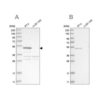 Anti-SCP2 antibody produced in rabbit Prestige Antibodies&#174; Powered by Atlas Antibodies, affinity isolated antibody, buffered aqueous glycerol solution, Ab2