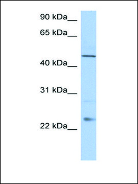 抗-TMCO1 兔抗 affinity isolated antibody