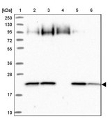 Anti-ARL8A antibody produced in rabbit Prestige Antibodies® Powered by Atlas Antibodies, affinity isolated antibody, buffered aqueous glycerol solution