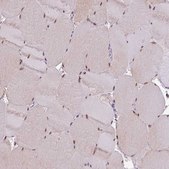 Anti-IRF2BPL antibody produced in rabbit Prestige Antibodies® Powered by Atlas Antibodies, affinity isolated antibody, buffered aqueous glycerol solution