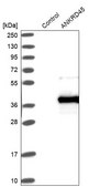 Anti-ANKRD45 antibody produced in rabbit Prestige Antibodies® Powered by Atlas Antibodies, affinity isolated antibody, buffered aqueous glycerol solution, ab1