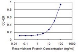 Monoclonal Anti-CAMK1G antibody produced in mouse clone 3E2, purified immunoglobulin, buffered aqueous solution