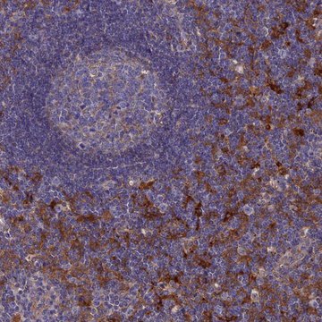 Anti-SNX11 antibody produced in rabbit Prestige Antibodies&#174; Powered by Atlas Antibodies, affinity isolated antibody, buffered aqueous glycerol solution