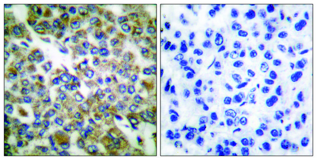 Anti-Keratin 14 antibody produced in rabbit affinity isolated antibody