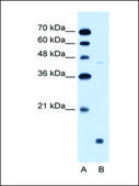 Anti-EDG8 (AB1) antibody produced in rabbit affinity isolated antibody