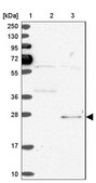 Anti-SPC24 antibody produced in rabbit Prestige Antibodies® Powered by Atlas Antibodies, affinity isolated antibody, buffered aqueous glycerol solution