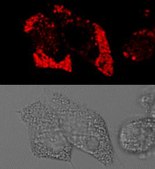 BioTracker™ LD-1 Near-IR Lipid Droplet Live Cell Probe