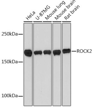 Anti-ROCK2 Antibody, clone 8G3U2, Rabbit Monoclonal