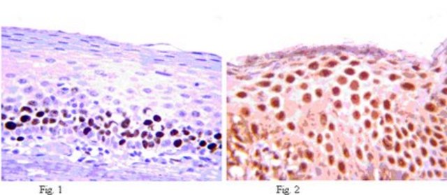 Anti-MEF2D Antibody from rabbit, purified by affinity chromatography