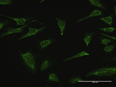 Anti-IMPA1 antibody produced in rabbit purified immunoglobulin, buffered aqueous solution