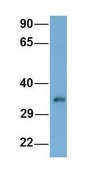 Anti-SIAH2 antibody produced in rabbit affinity isolated antibody
