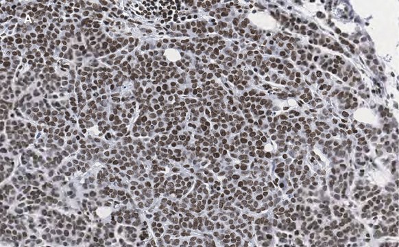 Anti-phospho-IRS1 (Tyr612) Antibody, clone 1N14, ZooMAb&#174; Rabbit Monoclonal recombinant, expressed in HEK 293 cells