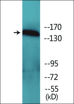 抗-磷酸化-VEGFR1 (pTyr1333) 兔抗 affinity isolated antibody