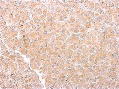 Monoclonal Anti-Citrate synthetase antibody produced in mouse clone GT1761, affinity isolated antibody