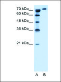 Anti-SLC6A18 antibody produced in rabbit IgG fraction of antiserum