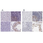 Anti-NASP antibody produced in rabbit Prestige Antibodies® Powered by Atlas Antibodies, affinity isolated antibody, buffered aqueous glycerol solution