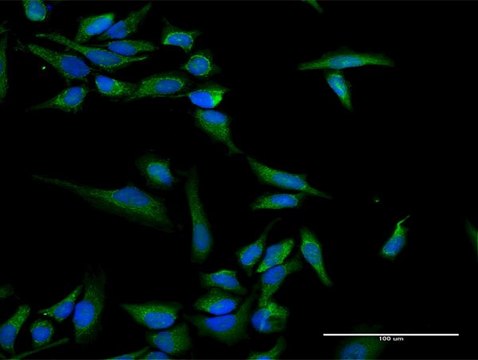 Anti-INPP5B antibody produced in rabbit purified immunoglobulin, buffered aqueous solution