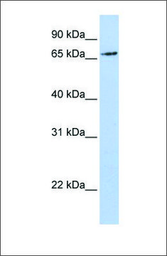 Anti-RNF139 antibody produced in rabbit affinity isolated antibody