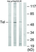 Anti-ETV6 antibody produced in rabbit affinity isolated antibody