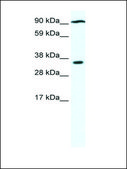 Anti-PARP16 antibody produced in rabbit affinity isolated antibody