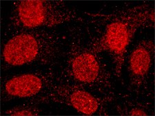 Anti-MLL2 antibody, Mouse monoclonal clone MLL2-A, purified from hybridoma cell culture