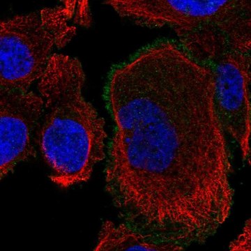 Anti-ROBO4 antibody produced in rabbit Prestige Antibodies&#174; Powered by Atlas Antibodies, affinity isolated antibody